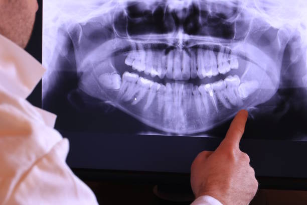 Best Emergency Gum Pain Relief  in Darby, PA