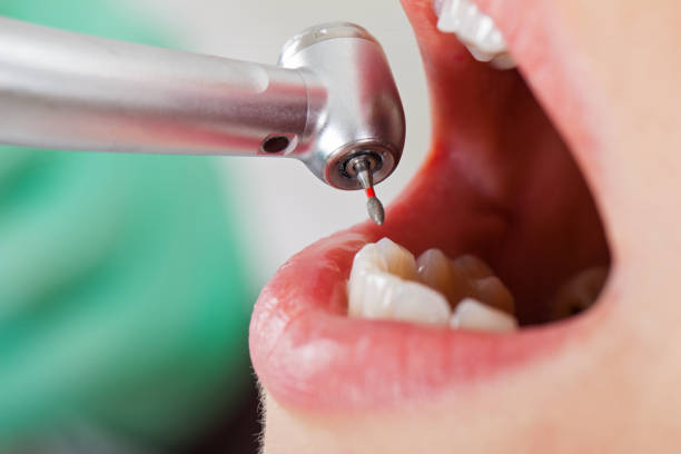Best Chipped Tooth Repair Near Me  in Darby, PA